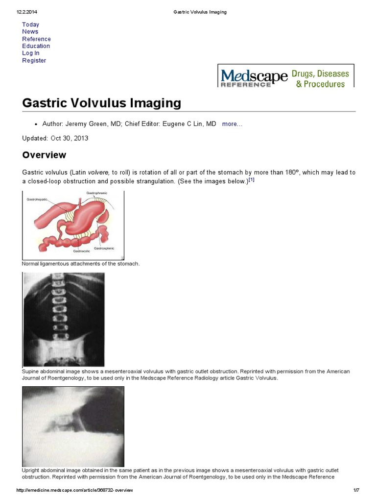 Gastric Volvulus Imaging Radiology Medical Imaging