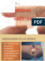 Heridas Abiertas