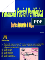 Paralisia Facial PerifÃƒÂ©rica