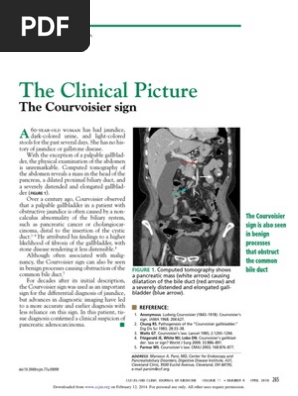 Courvoisier law | Gallbladder | Pancreas Courvoisier law | Gallbladder | Pancreas