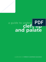 Cleft Lip Palate
