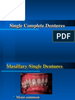 Single Complete Denture