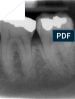 Anatomical Landmarks in Periapical Radiography