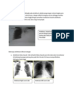 Atelektasis dan Radang Bronkus
