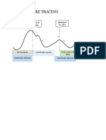 JVP Pressure Tracing: Opening of AV Valve Closure of AV Valve