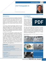 Cone Beam Computed Tomography in Endodontics (Inglês)