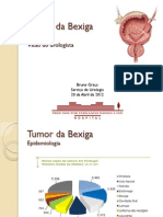 Tumor Da Bexiga