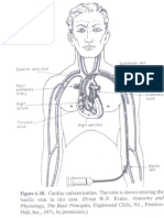 Cardiac Catheterization Explained