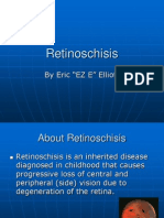 Retinoschisis