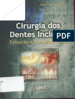 Cirurgia Dos Dentes Inclusos