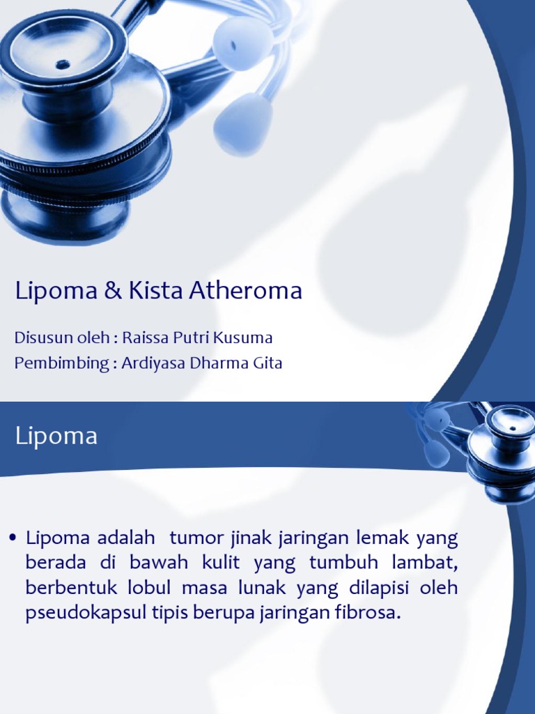 Lipoma & Kista Atheroma PDF