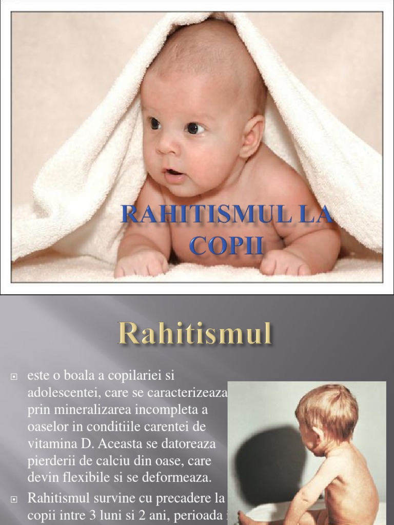 Rahitism | PDF