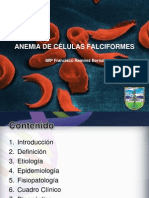 Anemia Falciforme Final