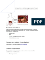 Pancreatectomia