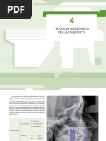 Trazado Anátomico Cefalométrico