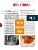 uveitis