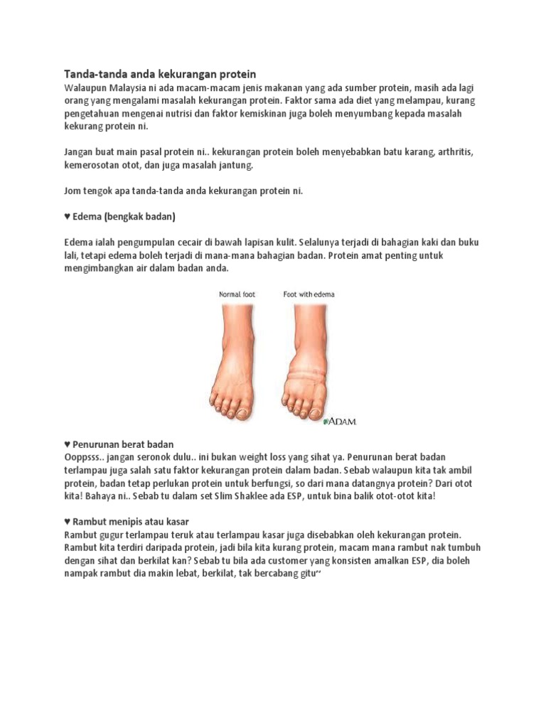 Tanda Kurang Protein Pdf