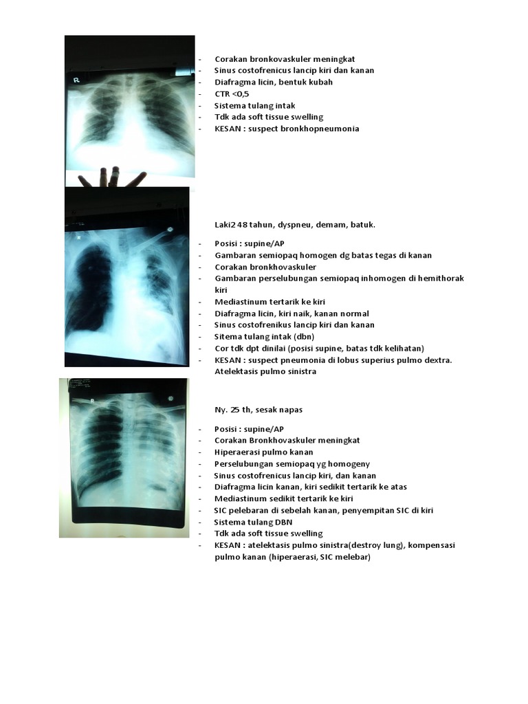 Osce (Radiologi) | PDF