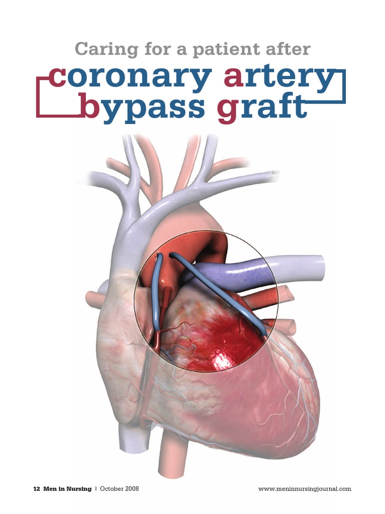 Cabg Nursing | PDF | Heart | Coronary Artery Bypass Surgery