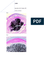 Pilar Cyst With Crystals. Deba P Sarma, MD