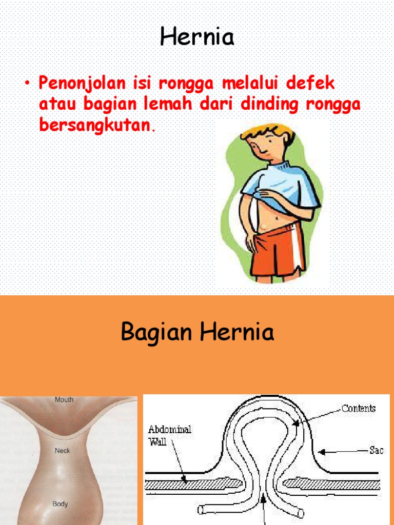 Hernia Reponibel dan Tatalaksananya | PDF