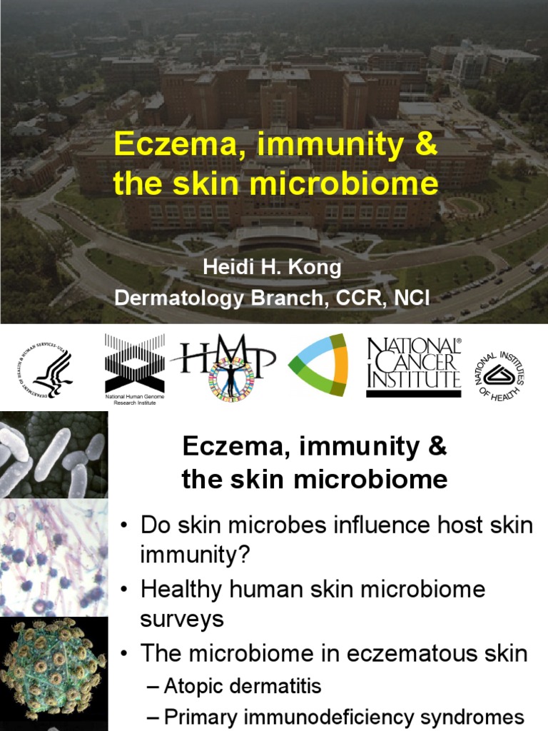Eczema, Immunity & The Skin Microbiome Heidi H. Kong Dermatology