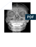 Curs Radio anatomie semestru 2 an 1