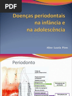 Doenças+periodontais+em+odontopediatria.sem+fotos