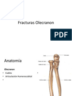 Fracturas Olecranon