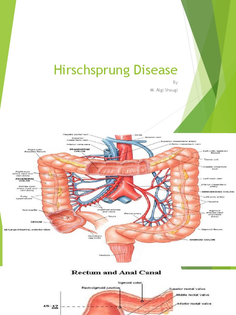 hirschsprung disease case study scribd