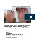 THE HANDS OF A 10 YEAR OLD CHILD SUFFERING FROM DIMENTIA