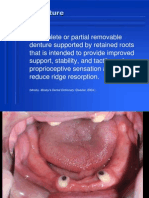 22. Overdentures