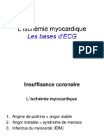 Cours ECG - Ischemie Myocardique I