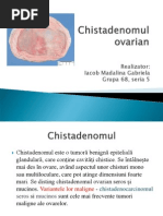 Iacob - Chistadenom Ovarian