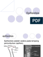 Epifisiolisis Fix