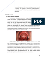 Ekterpasi Torus Palatinus