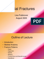 Facial Fractures