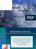 Miomatosis Ut