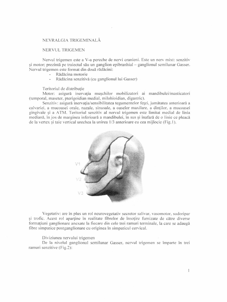 Nevralgia trigeminala