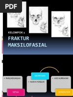 Download Ppt Fraktur Maxilla by Ricco Ardes SN210540203 doc pdf