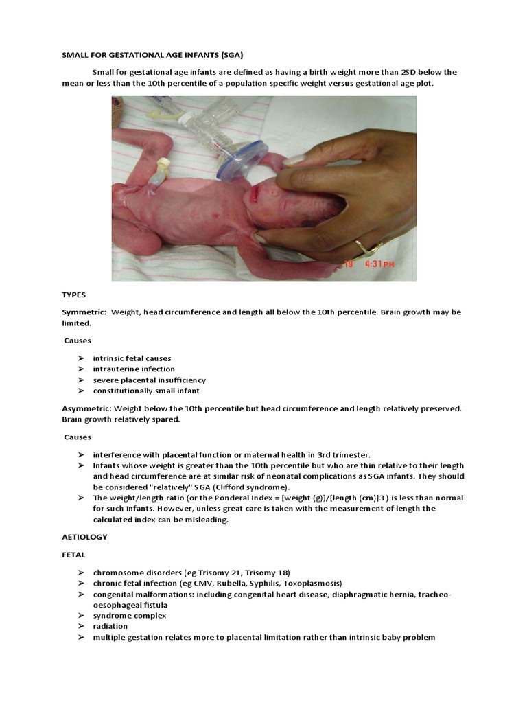 baby small for gestational age