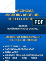 Carcinoma Microinvasor Del Cuello Uterino