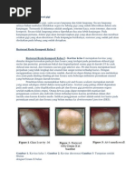 Download restorasi plastis komposit by Intan Permata Asti SN210763883 doc pdf