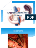 Tumores Endócrinos del páncreas