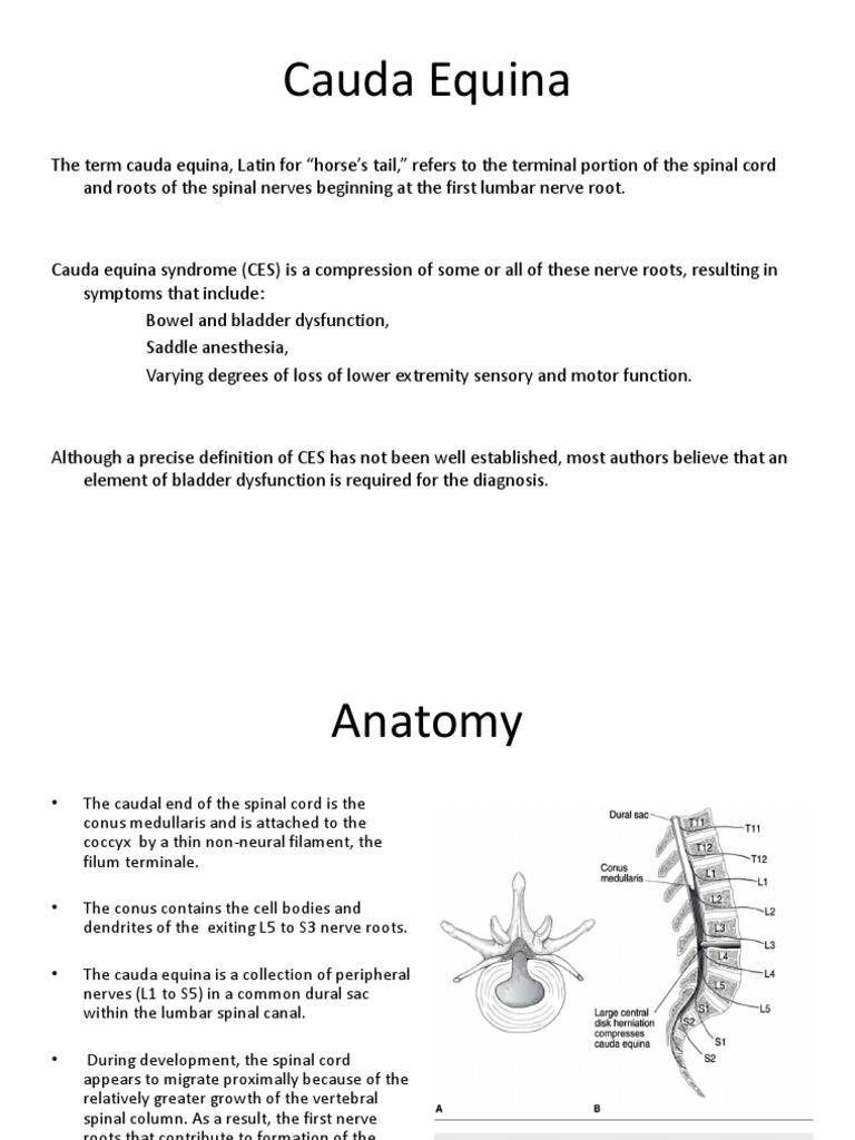 Cauada equina syn Spinal Cord Human Anatomy