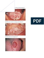 Oral Lesions