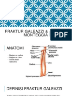 Fraktur galeazzi & Monteggia