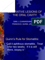 Ulcer Oral 021016 Slides