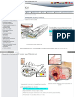 Atrapamiento Nervio Cubital