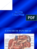 CA Pancreas 2